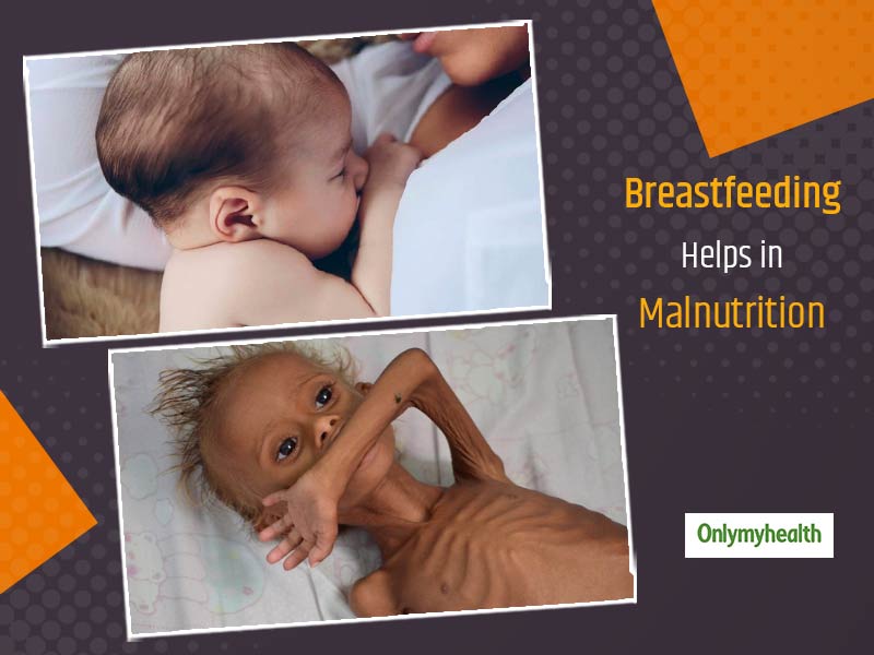 World Breastfeeding Week 2020 Can Breastfeeding Prevent Malnutrition In Infants Doctor Answers