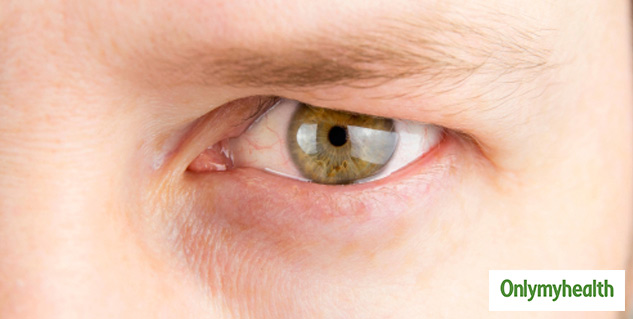 eyelids