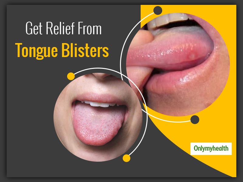 Under tongue bubble How to