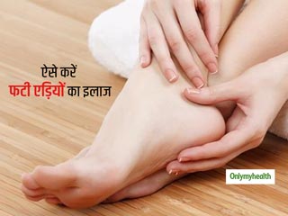बिना खर्च घर पर ही इन आसान तरीकों से करें फटी एड़ियों का इलाज, त्वचा भी बनी रहेगी चमकदार