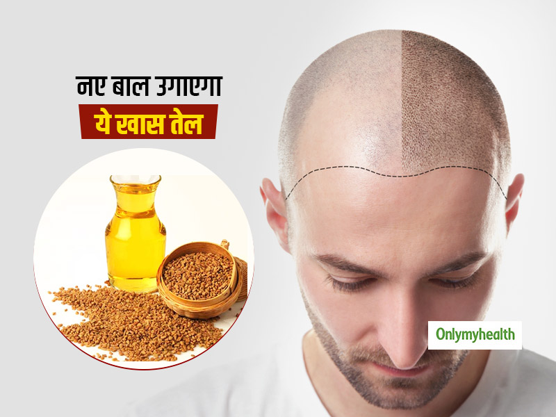 Hair Growth Tonic Made With Mustard Oil and Fenugreek Seeds or Methi to  Stop Hair Loss and Fall in Hindi | झड़ चुके बालों को दोबारा पाने और बालों  को घना बनाने