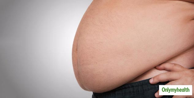 Obesity Can Cause Many Health Issues
