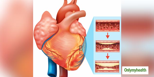 new-study-how-does-low-salt-diet-increase-the-risk-of-heart-attack