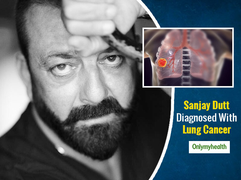 Breaking Sanjay Dutt Diagnosed With Lung Cancer Taking Break For Treatment