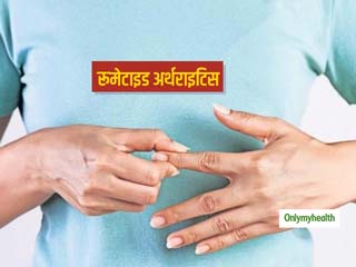 रूमेटाइड अर्थराइटिस के संकेतों को न करें नजरअंदाज, जोड़ों में दर्द के अलावा हो सकती हैं आपको ये 5 परेशानियां