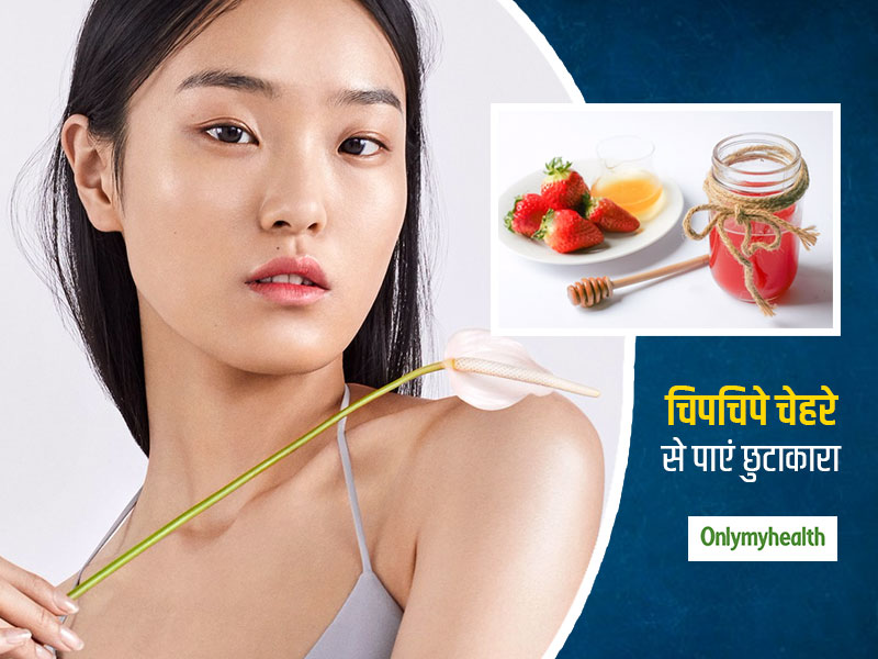ऑयली स्किन वाले इन दो चीजों का जरूर करें इस्तेमाल, कील-मुंहासे और चिपचिपे चेहरे से दिलाएगा निजात