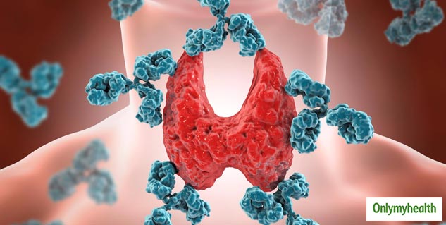 insidesignsofhashimotothyroiditis