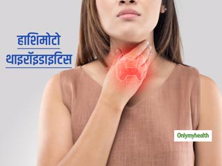क्या है हाशिमोटो थाइरॉइडाइटिस? डॉ. स्वाती बाथवाल से जानें थायराइड हार्मोन को संतुलित करने के आसान उपाय