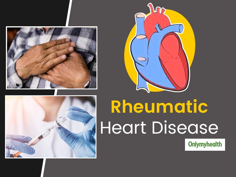 Rheumatic Heart Disease In Tagalog