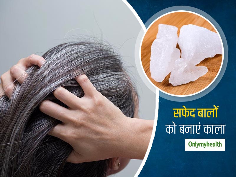 Hair Care Remedy: सफेद बालों को जड़ से बनाएं काला, महीने में बस 4 बार ट्राई करें ये हेयर केयर नुस्खा