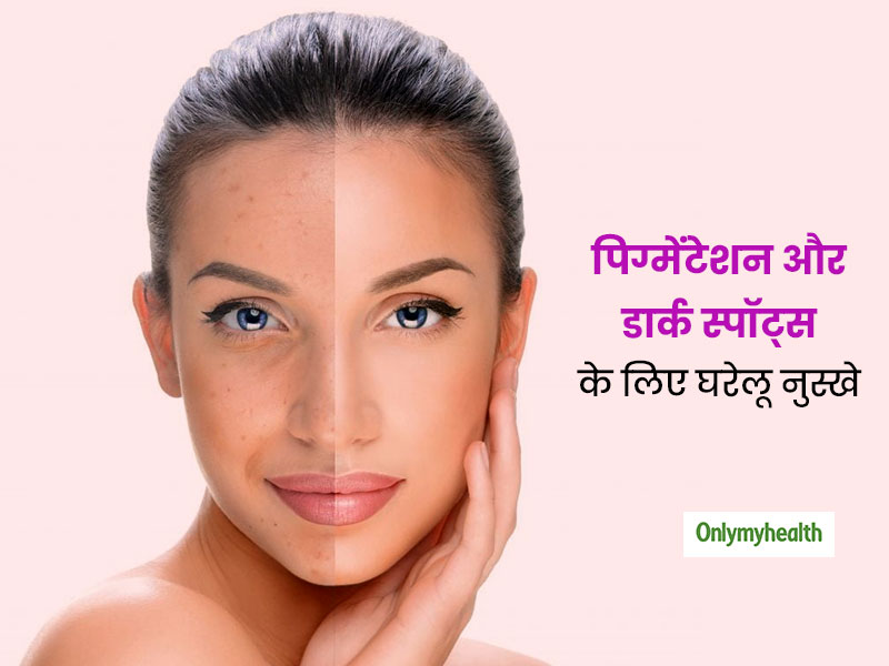त्वचा पर डार्क स्पॉट्स, पिग्मेंटेशन और अन्य दाग-धब्बों को साफ करने के आसान घरेलू उपाय, साफ होगी त्वचा की रंगत