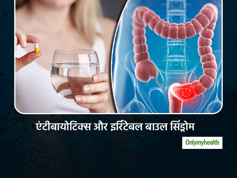बहुत अधिक एंटीबायोटिक दवाएं लेना बन सकता है इर्रिटेबल बाउल सिंड्रोम का कारण : शोध 