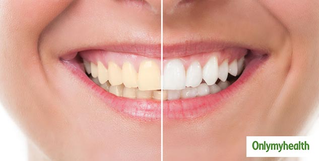 Insideyellowteething