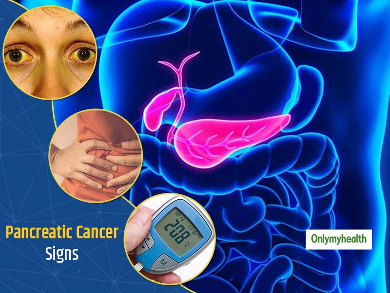 download diagnosing pancreatic cancer