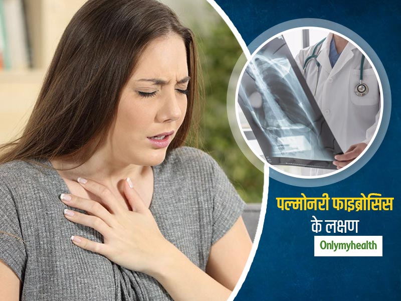 Pulmonary fibrosis: पल्मोनरी फाइब्रोसिस के ये लक्षण हो सकते हैं खतरनाक, जानें क्या है बचाव का तरीका