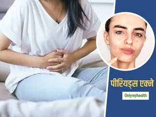 Periods Acne: क्या आपको भी पीरियड्स के दौरान निकल आते हैं मुहांसे? जानें पीरियड्स एक्ने से बचाव के टिप्स