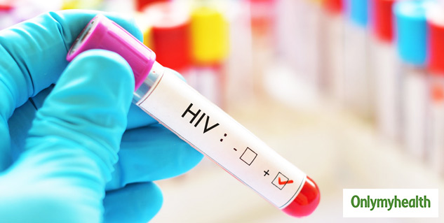 hiv treatment