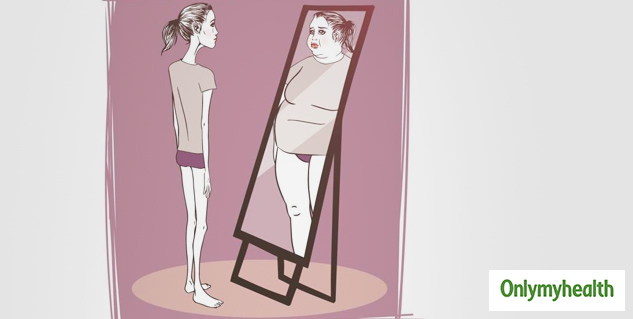 Anorexia Nervosa 