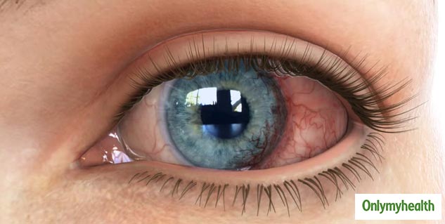 Insidepinkeye