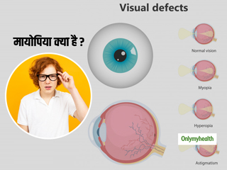 Myopia Causes Symptoms & Treatment: मायोपिया क्या है, जानें इसके लक्षण, कारण और बचाव के तरीके