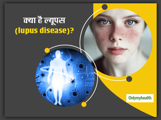 इम्यून सिस्टम की गड़बड़ी से जुड़ी हुई बीमारी है ल्यूपस (Lupus),जानें इसके कारण, लक्षण और ट्रीटमेंट