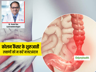 कोलन कैंसर के शुरुआती लक्षण नजरअंदाज करना क्यों है खतरनाक? जानें इस बीमारी के कारण और इलाज
