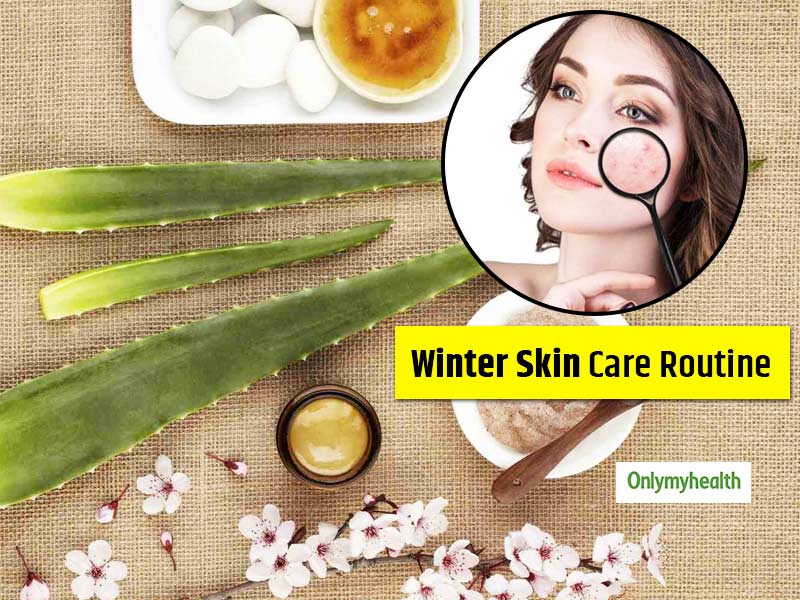 Follow These 10 Home Remedies For Acne-Prone Skin In Winter