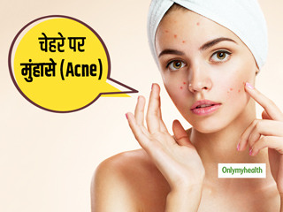 चेहरे पर मुंहासे (Acne) क्यों निकलते हैं? जानें इन 5 तरह के एक्ने को दूर करने के आसान उपाय