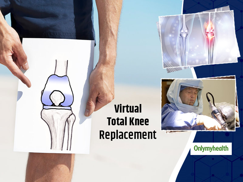 Virtual Total Knee Replacement: Know The Procedure, Effects, Pros And Cons  Of This Surgery - Virtual Total Knee Replacement: Know The Procedure,  Effects, Pros And Cons Of This Surgery