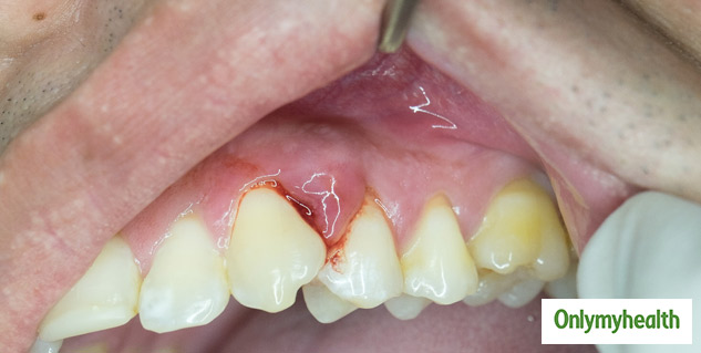 dental problems