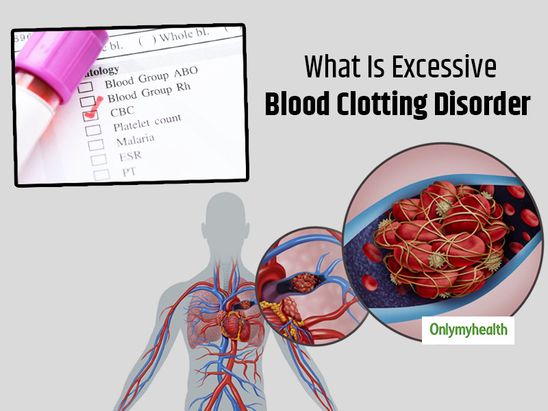 What causes blood clots in children? - Blood Clots