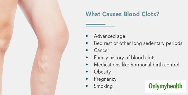 What Are the Signs of a Blood Clot?