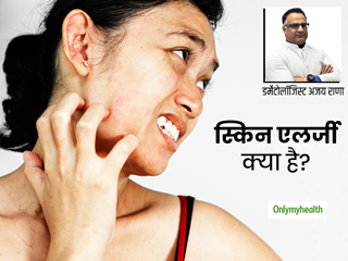 चेहरे पर एलर्जी और रैशेज  के पीछे कहीं आपका इम्यून सिस्टम तो नहीं? जानें स्किन एलर्जी के 2 प्रकार और 5 उपाय