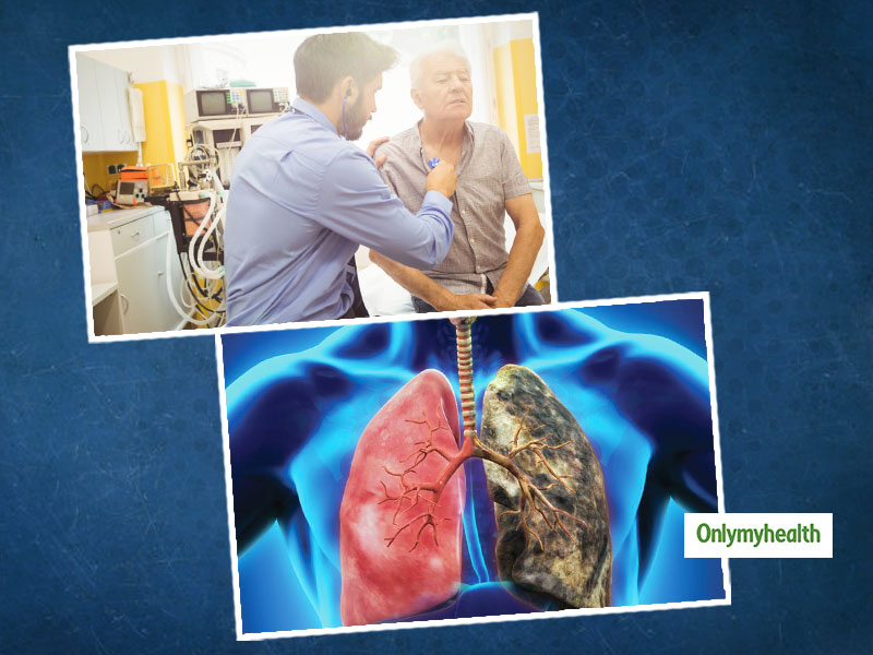 What Is Lung Cancer? Here Are Its Symptoms, Causes, Stages And Treatment