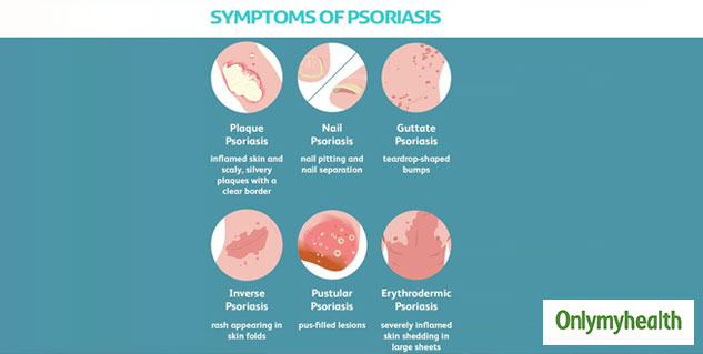 6 Types Of Auto-Immune Diseases That Are Common And Have No Cure ...