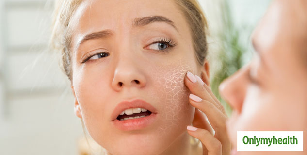 insidetypesofdryskin