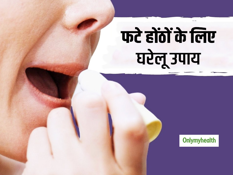 Follow These Home Remedies For Chapped Lips In Hindi । फटे होंठों के
