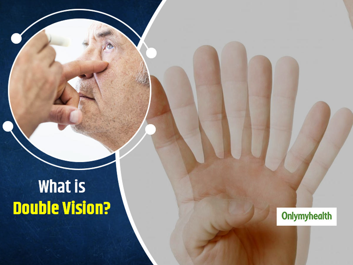 Do You See Everything Double? It Could Be Diplopia, Know Its Causes and  Treatment From Ophthalmologist