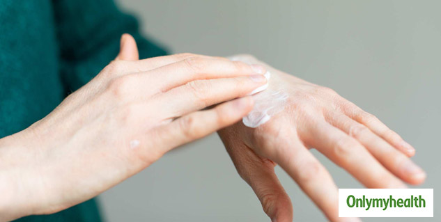 SKIN PROBLEM