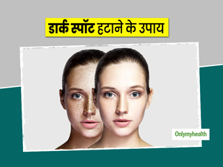डार्क स्पॉट्स ने खराब कर दिया आपका चेहरा? एक्सपर्ट से जानें स्किन के काले दाग-धब्बों को हटाने के लिए 10 उपाय