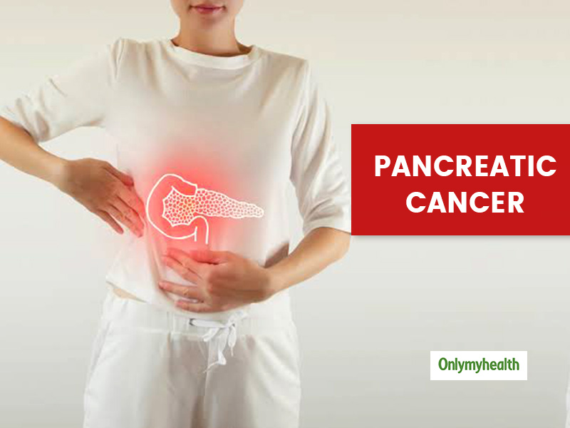 Pancreatic Cancer: Stages, Symptoms, Causes And Treatment | OnlyMyHealth