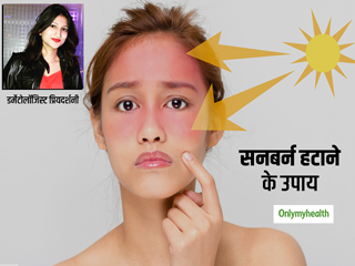 ठंड में देर तक धूप सेंकना बन सकता है चेहरे पर सनबर्न और टैन का कारण, एक्सपर्ट से जानें सनबर्न हटाने के 7 उपाय