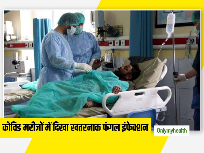 कोविड-19 के मरीजों में सामने आ रहे हैं खतरनाक फंगल इंफेक्शन के मामले, कई मरीजों की गई आंखों की रोशनी