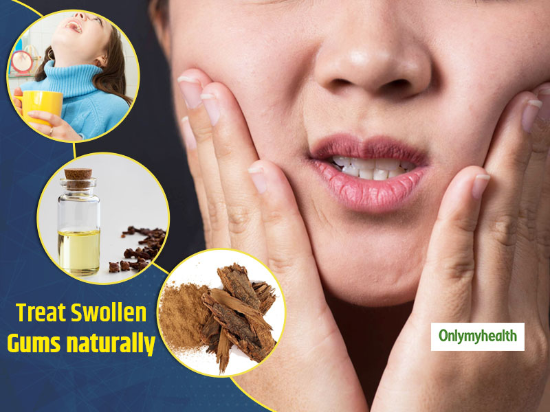 how to treat swollen gums