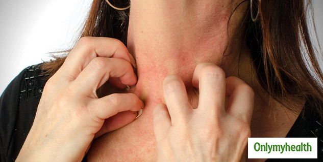 skin allergy from jewellery