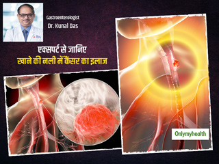 लगातार एसिडिटी और सीने में जलन हो सकता है खाने की नली में कैंसर (एसोफैगल कैंसर) का संकेत, जानें कारण, लक्षण
