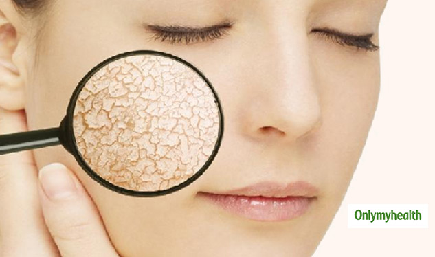 insidedehydrationinskin