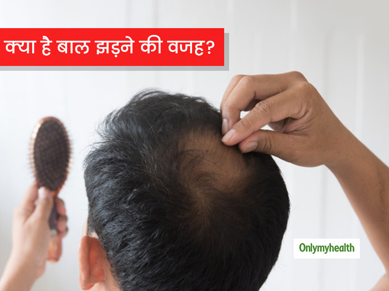 जयद बल टटन व झडन क 10 करण  Hair Fall Reasons in Hindi