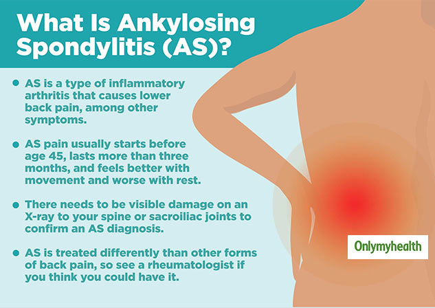 ankylosing spondylitis symptoms