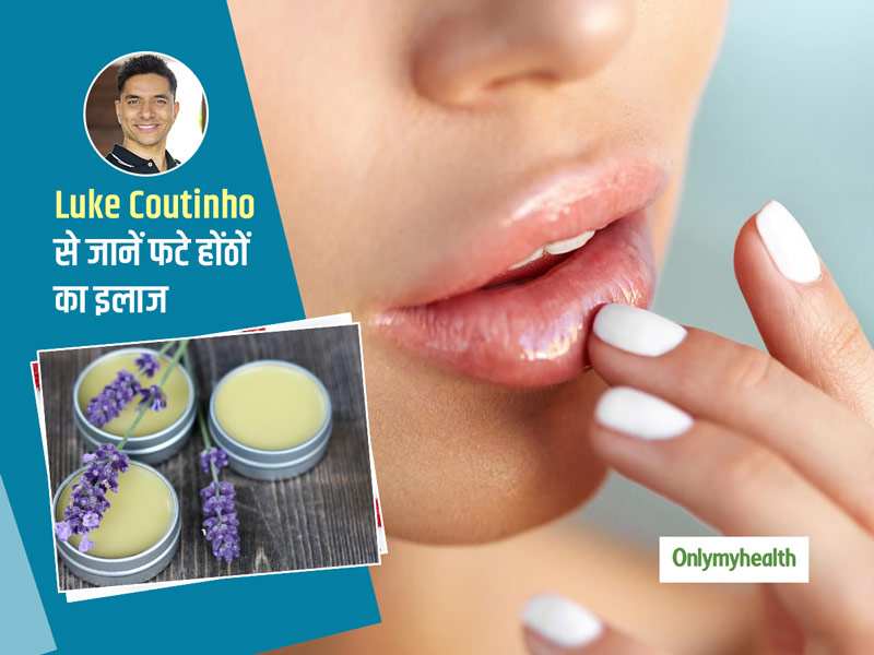 फटे होंठों को बनाएं मुलायम और खूबसूरत, इस्तेमाल करें ये खास होममेड लिप बाम  